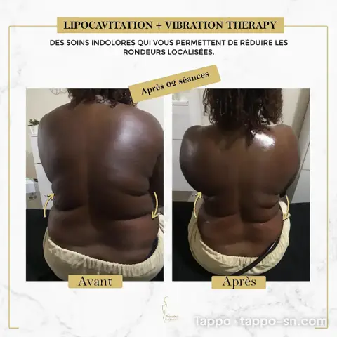 Soin lipocavitation et vibration therapy